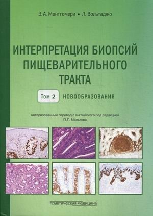 Интерпретация биопсий пищеварительного тракта. Руководство. Том 2: Новообразования фото книги