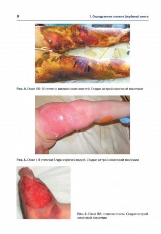 Атлас термических поражений фото книги 5