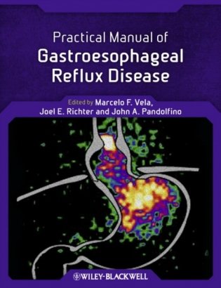 Practical Manual of Gastroesophageal Reflux Disease фото книги