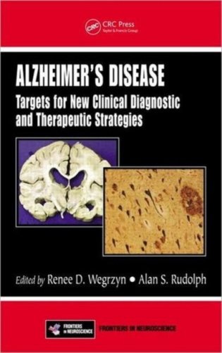 Alzheimer's Disease фото книги