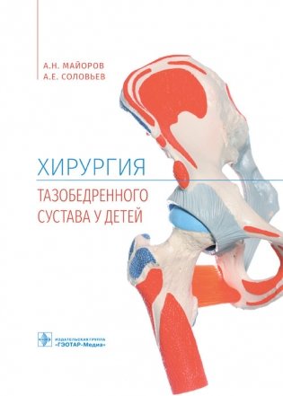 Хирургия тазобедренного сустава у детей фото книги