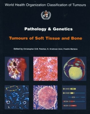 WHO Classification of Tumours Pathology & Genetics of Tumours of the Soft Tissue & Bone фото книги