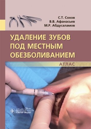 Удаление зубов под местным обезболиванием. Атлас фото книги
