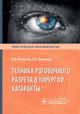 Техника роговичного разреза в хирургии катаракты фото книги