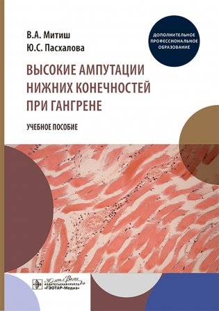 Высокие ампутации нижних конечностей при гангрене: Учебное пособие фото книги