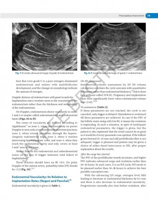 Decision Making In Transvaginal Sonography фото книги 7