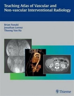 Teaching Atlas of Vascular and Non-vascular Interventional Radiology фото книги