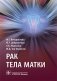 Рак тела матки фото книги маленькое 2