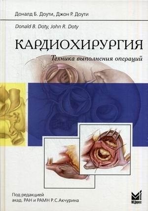 Кардиохирургия. Техника выполнения операций фото книги