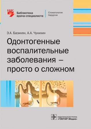 Одонтогенные воспалительные заболевания - просто о сложном фото книги