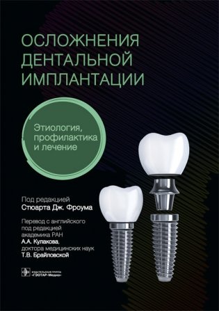 Осложнения дентальной имплантации. Этиология, профилактика и лечение фото книги