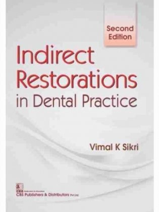 Indirect Restorations In Dental Practice 2Ed (Pb 2017) фото книги