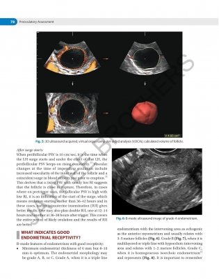 Decision Making In Transvaginal Sonography фото книги 6