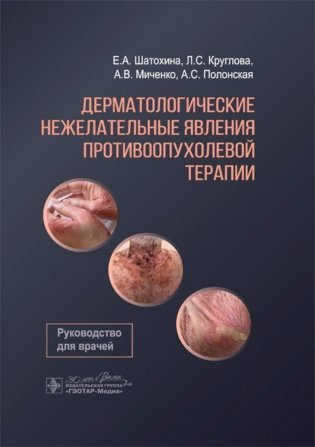 Дерматологические нежелательные явления противоопухолевой терапии: руководство для врачей фото книги