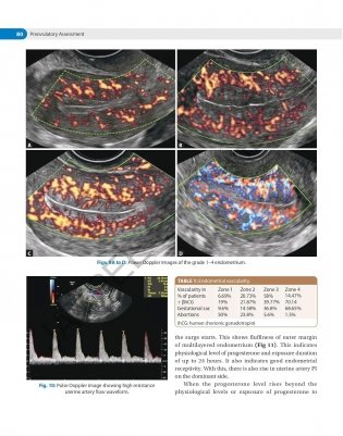 Decision Making In Transvaginal Sonography фото книги 8
