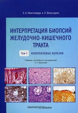 Интерпретация биопсий желудочно-кишечного тракта. Руководство. Том 1: Неопухолевые болезни фото книги