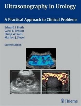 Ultrasonography in Urology фото книги