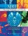 MRI Normal Variants and Pitfalls фото книги маленькое 2