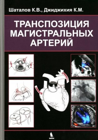 Транспозиция магистральных артерий фото книги