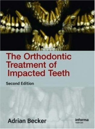 Orthodontic Treatment Impacted Teeth 2E фото книги