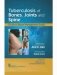 Tuberculosis Of Bones Joints And Spine (Hb 2017) фото книги маленькое 2