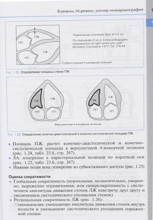 Справочник по эхокардиографии фото книги 10