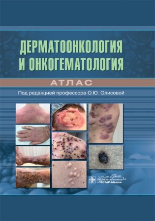 Дерматоонкология и онкогематология. Атлас фото книги