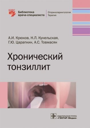 Хронический тонзиллит фото книги