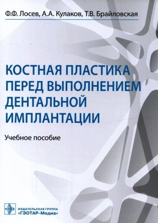 Костная пластика перед выполнением дентальной имплантации: Учебное пособие фото книги