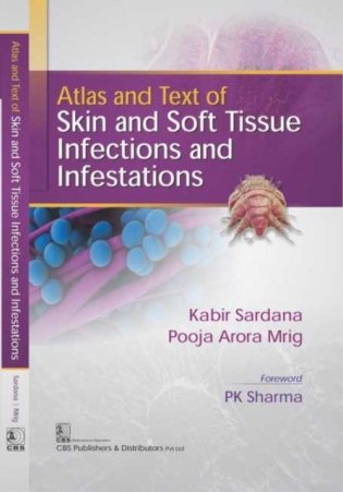 Atlas And Text Of Skin And Soft Tissue Infections And Infestations (Hb 2017) фото книги