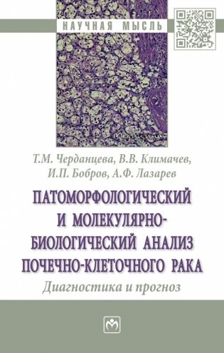 Патоморфологический и молекулярно-биологический анализ почечно-клеточного рака. Диагностика и прогноз фото книги