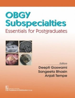 Obgy Subspecialties Essentials For Postgraduates (Pb 2019) фото книги