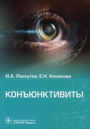Конъюнктивиты фото книги
