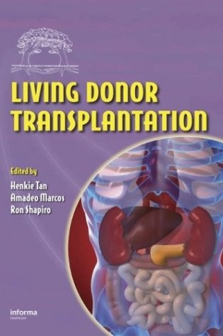 Living Donor Organ Transplantation фото книги
