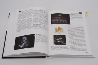 Клиническая эхокардиография: основной курс фото книги 2