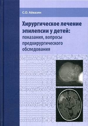 Хирургическое лечение эпилепсии у детей: показания, вопросы предхирургического обследования фото книги