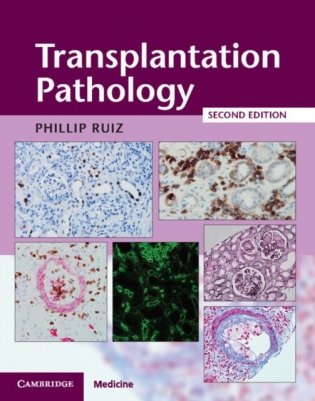 Transplantation Pathology Hardback with Online Resource фото книги