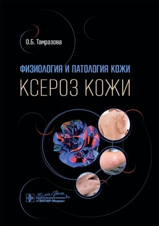 Физиология и патология кожи. Ксероз кожи фото книги