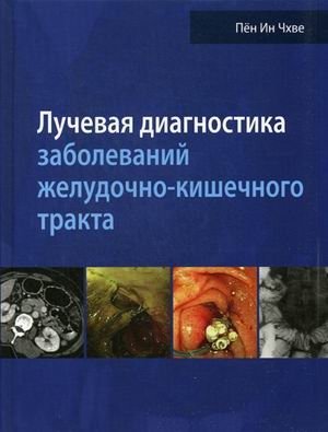 Лучевая диагностика заболеваний желудочно-кишечного тракта. Руководство фото книги