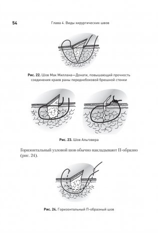Хирургический шов. 3-е издание, обновленное фото книги 10