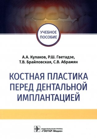 Костная пластика перед дентальной имплантацией: Учебное пособие фото книги