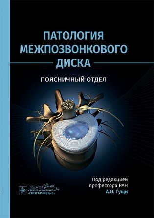 Патология межпозвонкового диска. Поясничный отдел фото книги
