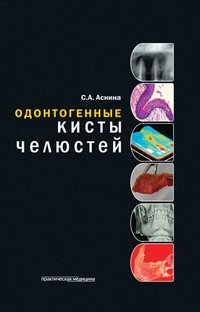 Одонтогенные кисты челюстей фото книги