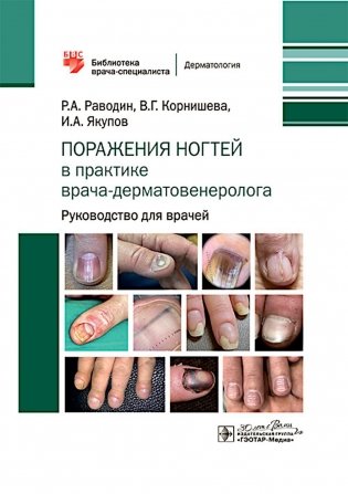 Поражения ногтей в практике врача-дерматовенеролога: руководство для врачей фото книги