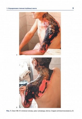 Атлас термических поражений фото книги 6