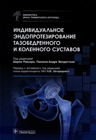 Индивидуальное эндопротезирование тазобедренного и коленного суставов фото книги