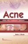 Acne Atlas With Treatment Options (Hb 2018) фото книги маленькое 2