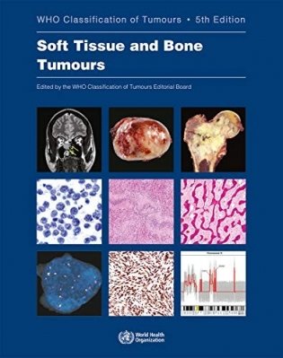Soft Tissue and Bone Tumours фото книги
