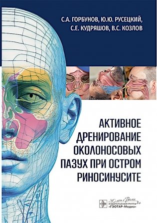 Активное дренирование околоносовых пазух при остром риносинусите фото книги