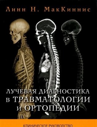 Лучевая диагностика в травматологии и ортопедии. Клиническое руководство фото книги